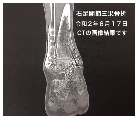 9D40E588-42D2-4BC5-ABF1-9390D202DFB6.jpeg